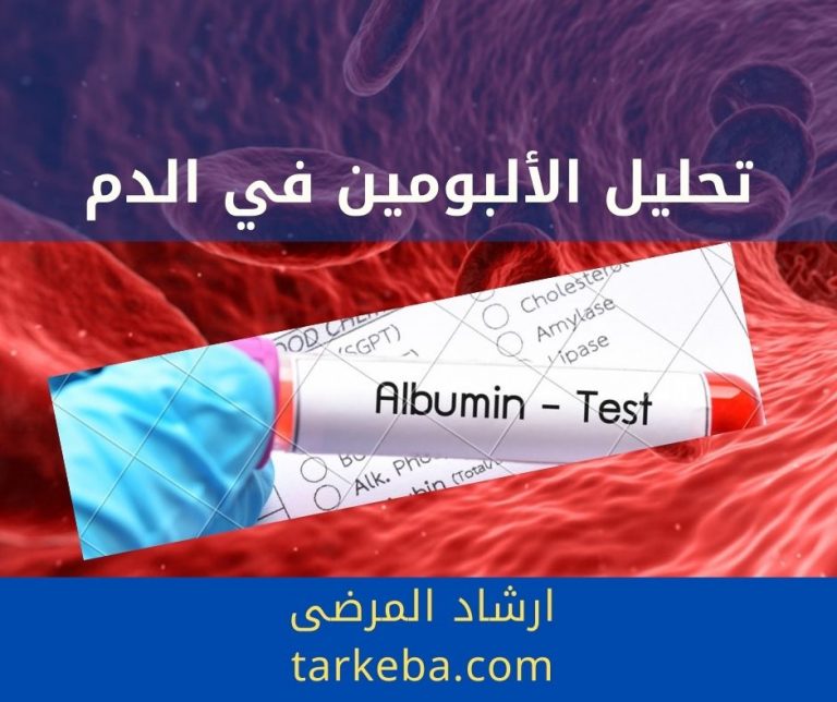 Read more about the article تحليل الألبومين في الدم