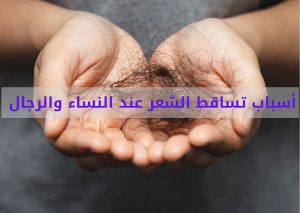 Read more about the article أسباب تساقط الشعر عند النساء والرجال